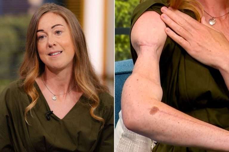 Brutal ataque de Tiburón casi le cuesta el brazo: sobrevivió con tres cirugías